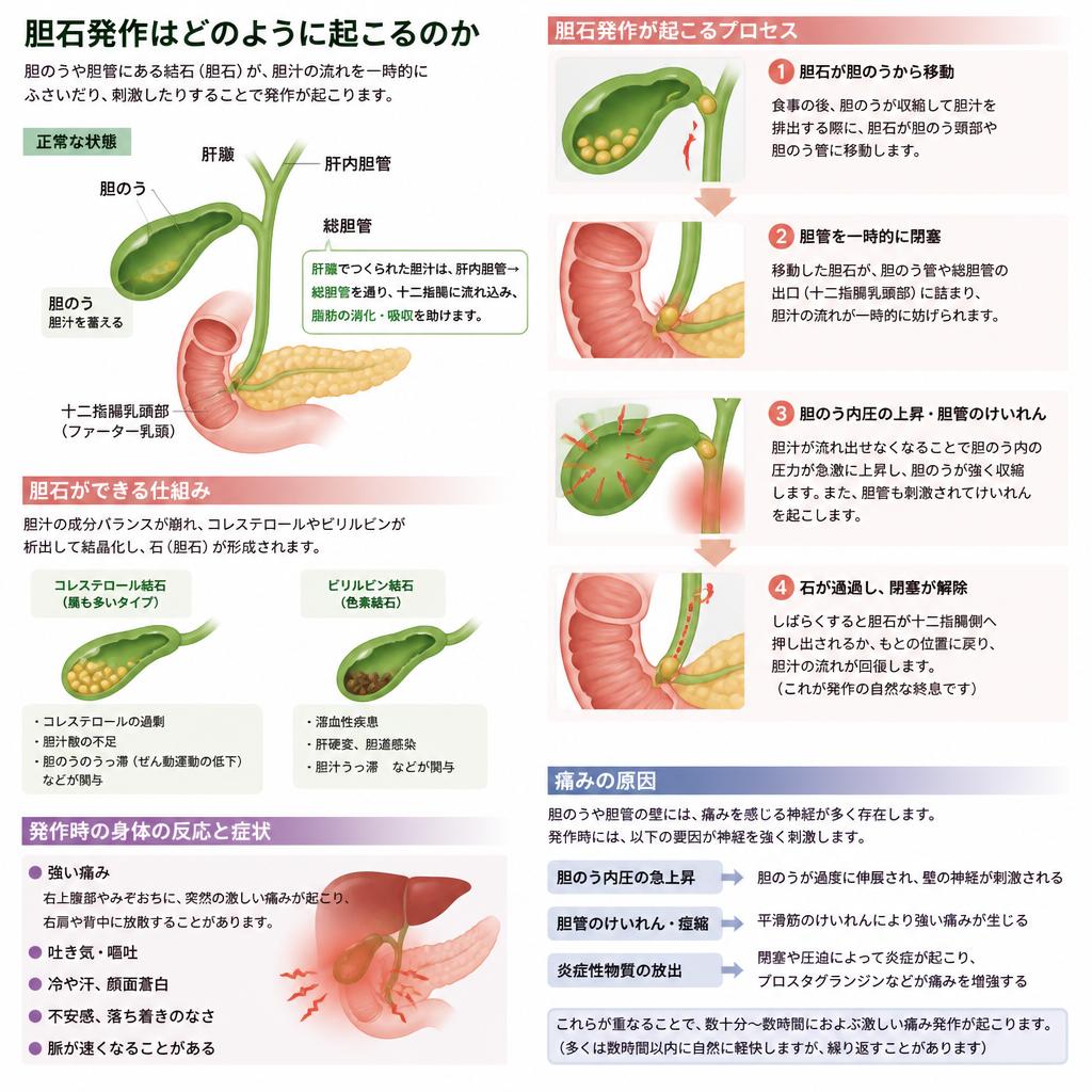 胆石発作のメカニズム