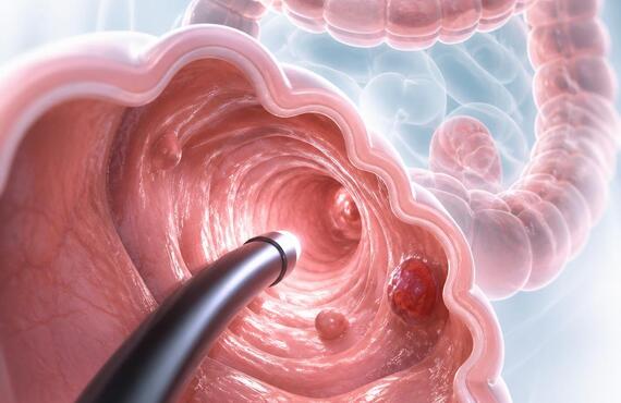 便潜血陽性を見逃さない！腸の健康を守る内視鏡検査　　　　武蔵小杉せのお内科クリニック