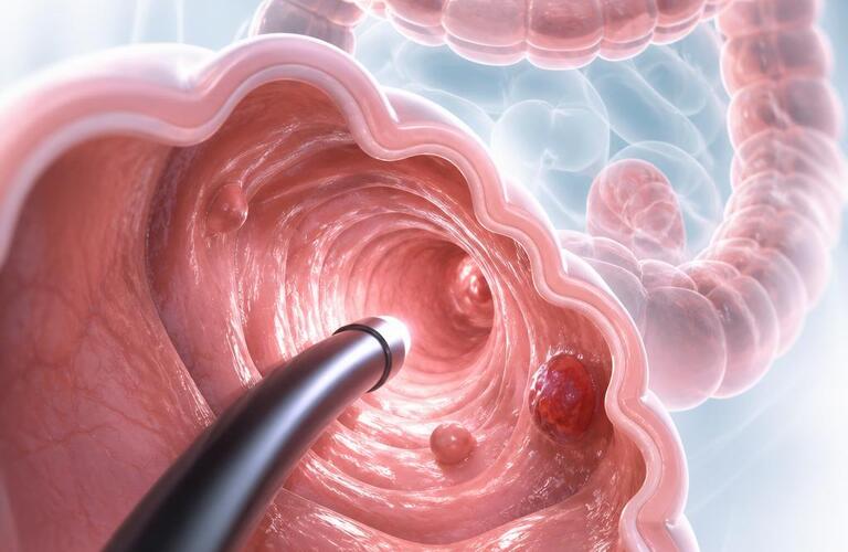 便潜血陽性を見逃さない！腸の健康を守る内視鏡検査　　　　武蔵小杉せのお内科クリニック