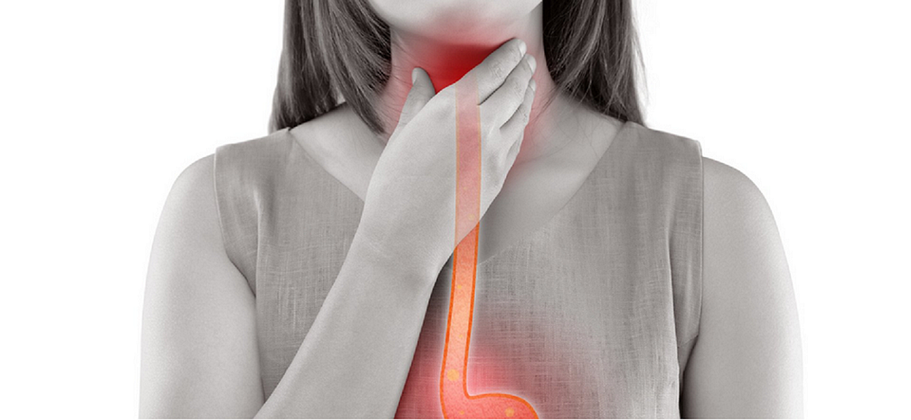 逆流性食道炎を乗り越え、健康な毎日を送るために。